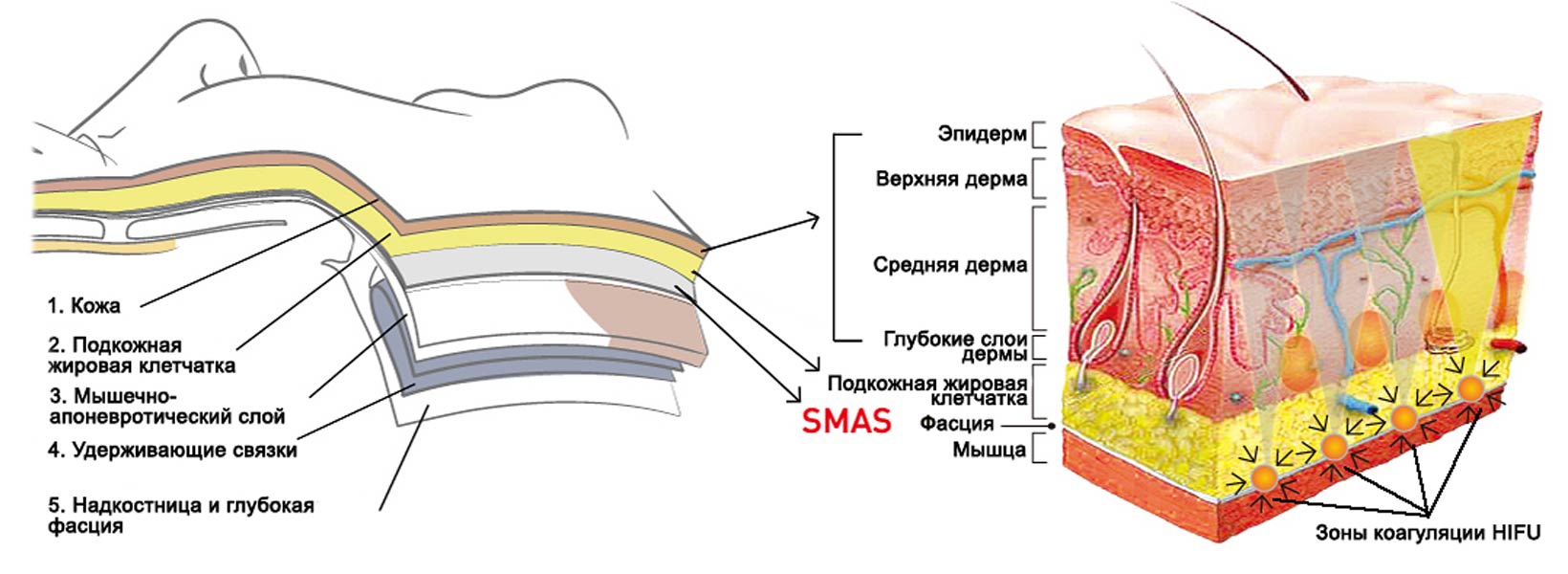 Заголовок